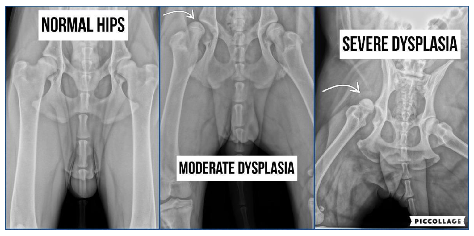 Hip Xray